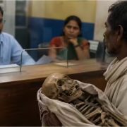 जब एक व्यक्तिले बहिनीको अस्थिपञ्जर नै बोकेर बैंक पुगे