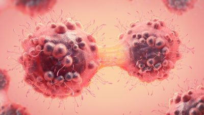 विश्व क्यान्सर दिवसः समयमै पहिचान र उपचार नै जीवन रक्षा