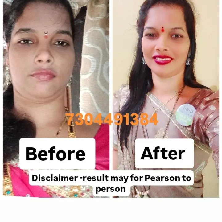 Rupali kadu